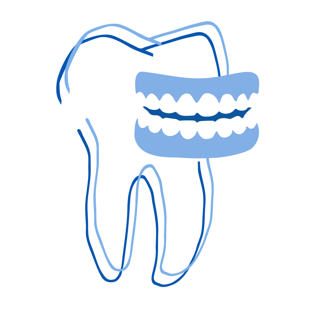 Zahnersatz / Prothesen